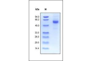 Human Noggin, Fc Tag on SDS-PAGE under reducing (R) condition. (NOG Protein (AA 28-232) (Fc Tag))