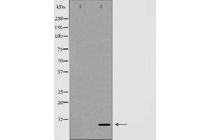 Western blot analysis of Hela whole cell lysates, using GLRX Antibody. (Glutaredoxin 1 Antikörper  (N-Term))