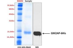 Western Blotting (WB) image for GM2 Ganglioside Activator (GM2A) (Isoform 1) protein (His tag) (ABIN5675809) (GM2A Protein (Isoform 1) (His tag))