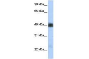 Image no. 1 for anti-Sarcoglycan, beta (43kDa Dystrophin-Associated Glycoprotein) (SGCB) (AA 180-229) antibody (ABIN6740863) (SGCB Antikörper  (AA 180-229))