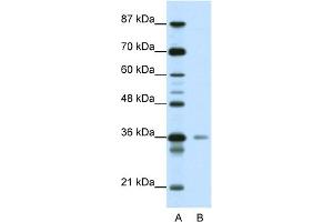 WB Suggested Anti-HMG20A Antibody Titration:  0. (HMG20A Antikörper  (C-Term))