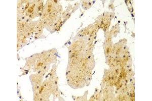 Immunohistochemistry of paraffin-embedded Human esophagus using MVP Polyclonal Antibody at dilution of 1:100 (40x lens). (MVP Antikörper)