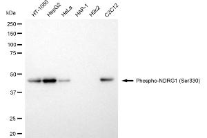 Western blotting analysis using phospho-NDRG1 (Ser330) antibody (ABIN7799537). (Rekombinanter NDRG1 Antikörper  (pSer330))