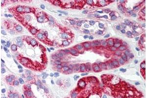 Human Kidney (formalin-fixed, paraffin-embedded) stained with SCO2 antibody ABIN214472 at 2. (SCO2 Antikörper  (C-Term))