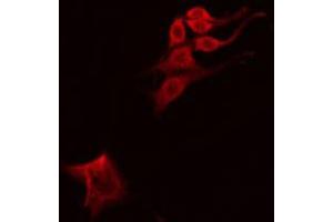 Immunofluorescence (fixed cells) (IF/ICC) image for anti-ADAM Metallopeptidase with Thrombospondin Type 1 Motif, 19 (ADAMTS19) (Internal Region) antibody (ABIN6257740)