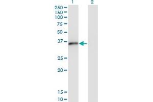 Western Blot analysis of MSX2 expression in transfected 293T cell line by MSX2 monoclonal antibody (M10), clone 1E8.