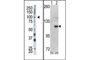 Image no. 1 for anti-Hexokinase 1 (HK1) (N-Term) antibody (ABIN360644) (Hexokinase 1 Antikörper  (N-Term))
