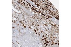 Immunohistochemical staining of human placenta with PGBD2 polyclonal antibody  shows strong positivity in decidual cells at 1:10-1:20 dilution. (PGBD2 Antikörper)
