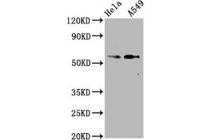 Western Blot Positive WB detected in Hela whole cell lysate,A549 whole cell lysate All lanes Phospho-SMAD2 antibody at 1. (Rekombinanter SMAD2 Antikörper  (pSer250))