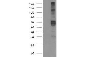 Western Blotting (WB) image for anti-Transmembrane Protease, serine 5 (TMPRSS5) antibody (ABIN1501445) (TMPRSS5 Antikörper)