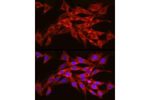 Immunofluorescence analysis of NIH/3T3 cells using SEC61 Rabbit pAb (1614) at dilution of 1:350 (40x lens). (SEC61A1 Antikörper  (AA 310-420))
