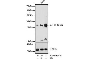 Western blot analysis of extracts of HeLa cells using Phospho-HSPB1(S82) Polyclonal Antibody at dilution of 1:1000.