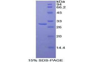 SDS-PAGE (SDS) image for TGF-beta Activated Kinase 1/MAP3K7 Binding Protein 1 (TAB1) (AA 189-439) protein (His tag) (ABIN2125927) (TAB1 Protein (AA 189-439) (His tag))