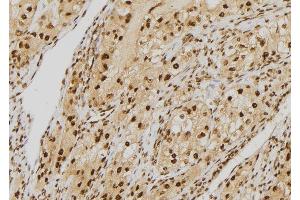 ABIN6277572 at 1/100 staining Human kidney tissue by IHC-P.
