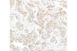 Immunohistochemistry (IHC) image for anti-Cullin 4A (CUL4A) (C-Term) antibody (ABIN7453591) (Cullin 4A Antikörper  (C-Term))