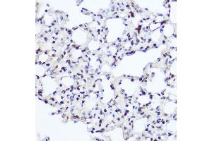 Immunohistochemistry of paraffin-embedded rat lung using NFIA Rabbit pAb (ABIN1681040, ABIN3017626, ABIN3017627 and ABIN6220178) at dilution of 1:200 (40x lens). (NFIA Antikörper  (AA 180-330))