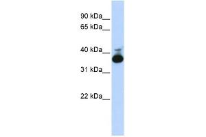 WB Suggested Anti-ALDOB Antibody Titration:  0. (ALDOB Antikörper  (Middle Region))