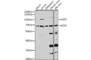 Western blot analysis of extracts of various cell lines, using EGR1 antibody (ABIN3016527, ABIN3016528, ABIN3016529 and ABIN1679679) at 1:1000 dilution. (EGR1 Antikörper)