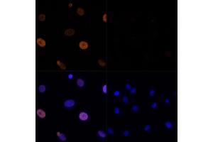 Immunofluorescence analysis of C6 cells using Acetyl-Histone H3-K56 Rabbit pAb (ABIN7267674) at dilution of 100 (40x lens).