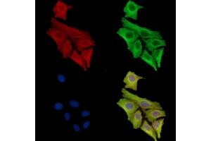 ABIN7097103 and ABIN7101170 staining Hela cells by IF/ICC.