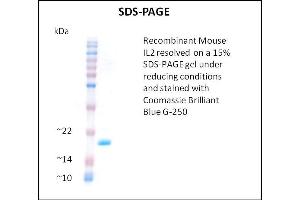 SDS-PAGE (SDS) image for Interleukin 2 (IL2) (Active) protein (ABIN5509345) (IL-2 Protein)