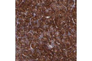 Immunohistochemical staining of human pancreas with USP51 polyclonal antibody  shows strong cytoplasmic positivity in exocrine glandular cells at 1:50-1:200 dilution. (USP51 Antikörper)