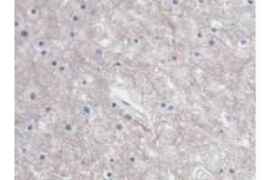IHC-P analysis of Human Cerebrum Tissue, with DAB staining. (S100B Antikörper  (AA 1-92))
