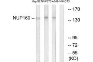 Western blot analysis of extracts from NIH-3T3/A549/HepG2 cells, using NUP160 Antibody. (NUP160 Antikörper  (AA 392-441))