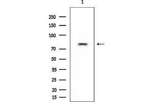 Western blot analysis of lysates from Mouse liver, using VCAM1 Mouse Monoclonal Antibody at 1/1000 dilution.