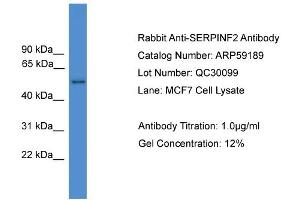 WB Suggested Anti-SERPINF2  Antibody Titration: 0. (alpha 2 Antiplasmin Antikörper  (N-Term))