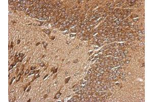IHC-P Image Immunohistochemical analysis of paraffin-embedded CL1-5 xenograft, using RPL29, antibody at 1:500 dilution. (RPL29 Antikörper)