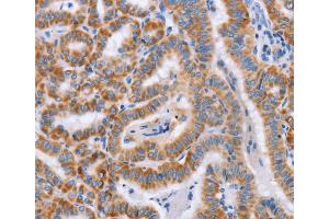 Immunohistochemistry (IHC) image for anti-Bone Marrow Stromal Cell Antigen 1 (BST1) antibody (ABIN2434360) (BST1 Antikörper)