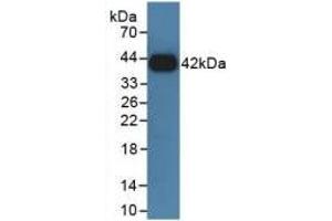 Western blot analysis of recombinant Rat GHR. (Growth Hormone Receptor Antikörper  (AA 353-588))