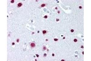 Immunohistochemistry (IHC) image for anti-Scaffold Attachment Factor B (SAFB) (AA 345-357) antibody (ABIN2469786)