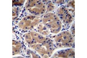 RAB27B antibody immunohistochemistry analysis in formalin fixed and paraffin embedded human stomach tissue.