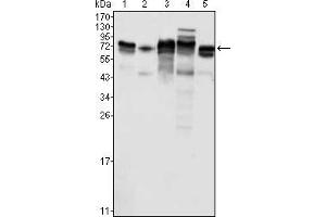 Western blot analysis using Metadherin mouse mAb against K562 (1), SKBR-3 (2), T47D (3), Hela (4) and MCF-7 (5) cell lysate.
