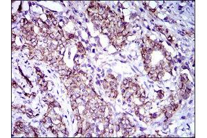 Immunohistochemistry (IHC) image for anti-Activated Leukocyte Cell Adhesion Molecule (ALCAM) (AA 48-216) antibody (ABIN1846222) (CD166 Antikörper  (AA 48-216))
