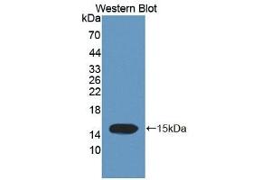 Detection of Recombinant TCHH, Human using Polyclonal Antibody to Trichohyalin (TCHH) (Trichohyalin Antikörper  (AA 1851-1943))