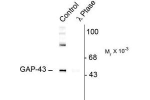 Image no. 2 for anti-Growth Associated Protein 43 (GAP43) (pSer41) antibody (ABIN227321) (GAP43 Antikörper  (pSer41))