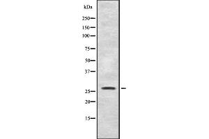 Western blot analysis of SYF2 expression in Mouse liver lysate,The lane on the left is treated with the antigen-specific peptide. (SYF2 Antikörper  (C-Term))