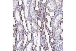 Immunohistochemical staining of human kidney with ACSM1 polyclonal antibody  shows strong cytoplasmic positivity in cells in tubules at 1:20-1:50 dilution. (ACSM1 Antikörper)
