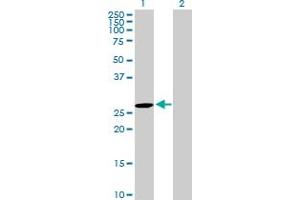 Western Blot analysis of DUPD1 expression in transfected 293T cell line by DUPD1 MaxPab polyclonal antibody. (DUPD1 Antikörper  (AA 1-220))