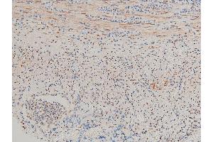 Immunohistochemistry (IHC) image for anti-LIM Domain Kinase 1 (LIMK1) (pThr508) antibody (ABIN6255701)