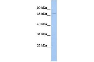 WB Suggested Anti-UGT3A2 Antibody Titration:  0. (UGT3A2 Antikörper  (Middle Region))