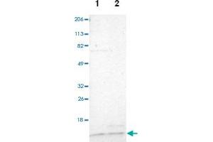 Western blot analysis of Lane 1: Human cell line RT-4, Lane 2: Human cell line U-251MG sp with TIMM9 polyclonal antibody  at 1:100-1:250 dilution. (TIMM9 Antikörper)