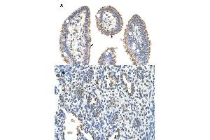 Immunohistochemical staining (Formalin-fixed paraffin-embedded sections) of (A) human intestine and (B) human lung tissues with KRT2 polyclonal antibody . (Keratin 2 Antikörper  (AA 351-400))