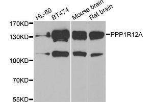 Western blot analysis of extracts of various cell lines, using PPP1R12A antibody (ABIN5974045) at 1/1000 dilution. (PPP1R12A Antikörper)