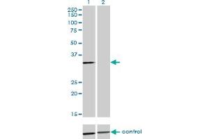 Western blot analysis of ANXA3 over-expressed 293 cell line, cotransfected with ANXA3 Validated Chimera RNAi (Lane 2) or non-transfected control (Lane 1).