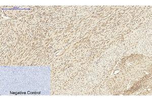 Immunohistochemical analysis of paraffin-embedded human uterus tissue. (DNMT3B Antikörper  (AA 1-80))