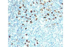 IHC testing of human tonsil stained with Kappa antibody (KLC264).